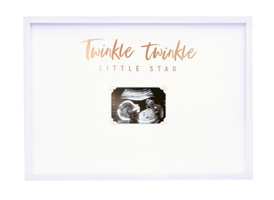 Twinkle Twinkle Baby Scan Guest Book Frame